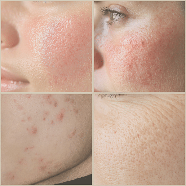 E-Book Online | Balans in huidproblemen